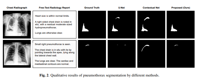 Quantitative Results