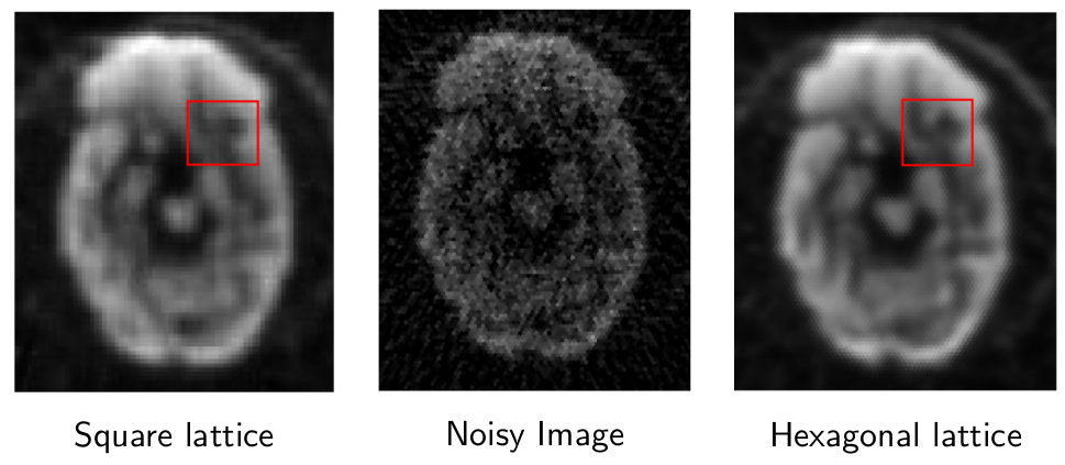 Denoise Comparision