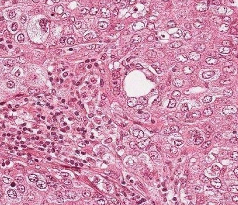 Histo Pathology