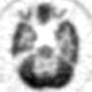 Image Reconstruction