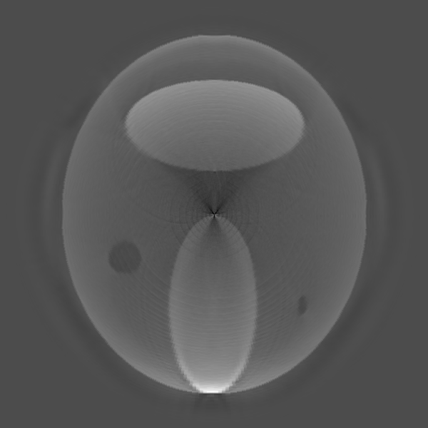 Radon Transform