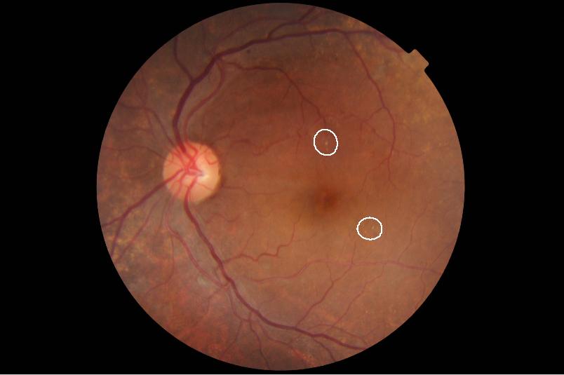 retina ori